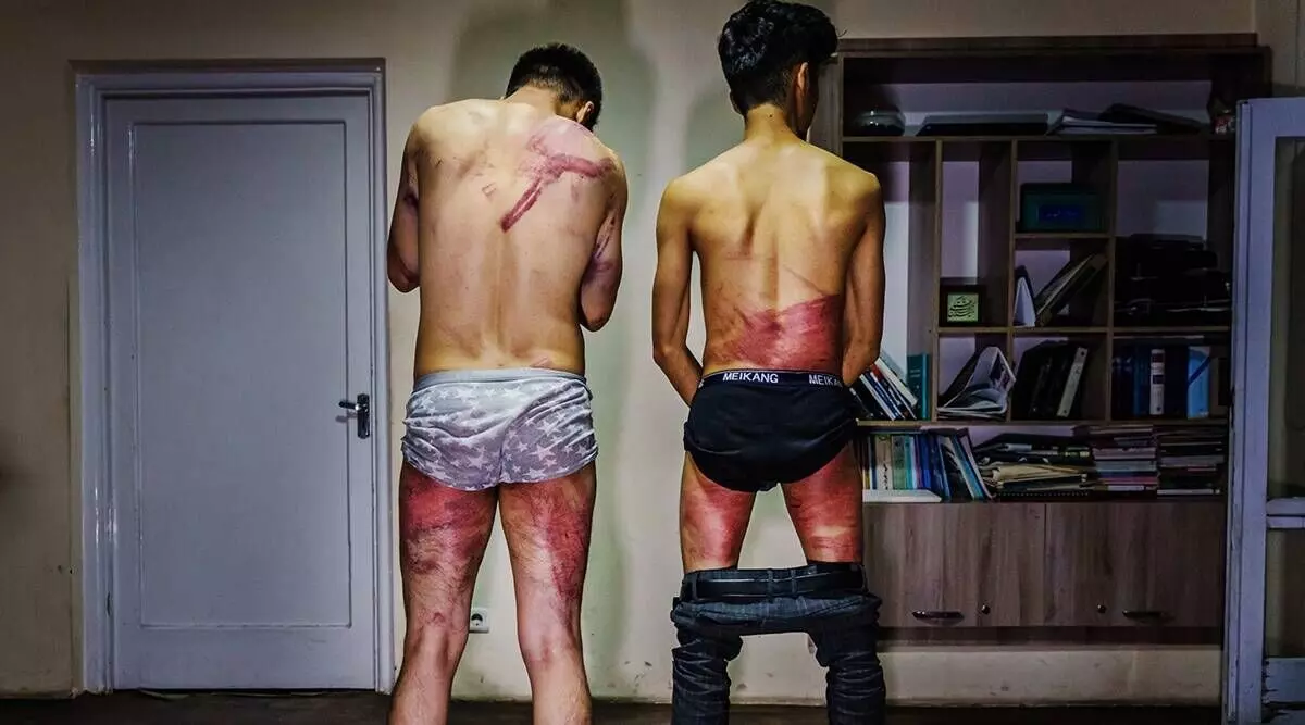 Two journalists detained, beaten up for covering womens rights protests in Kabul Two journalists detained, beaten up for covering womens rights protests in Kabul