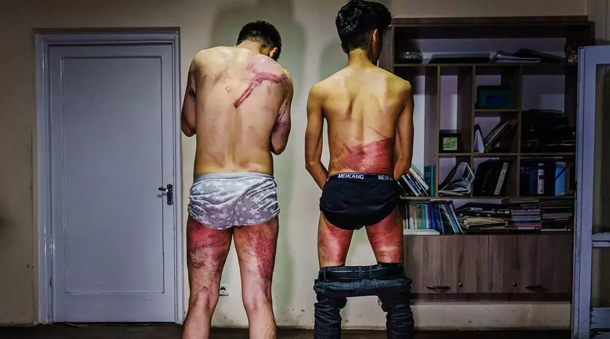 Two journalists detained, beaten up for covering womens rights protests in Kabul Two journalists detained, beaten up for covering womens rights protests in Kabul